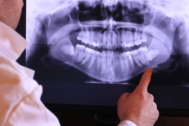 Best Broken or Cracked Tooth Emergency Dentist in Southeast Arcadia, FL